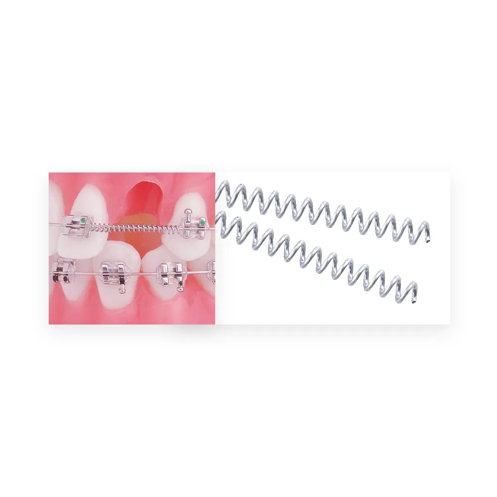 U Ortho NiTi Open Spring 0.010 Inch 180mm
