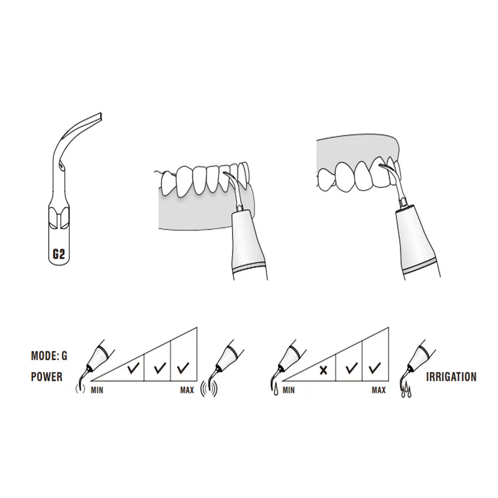 Woodpecker Scaler Tip for UDS & EMS Scalers
