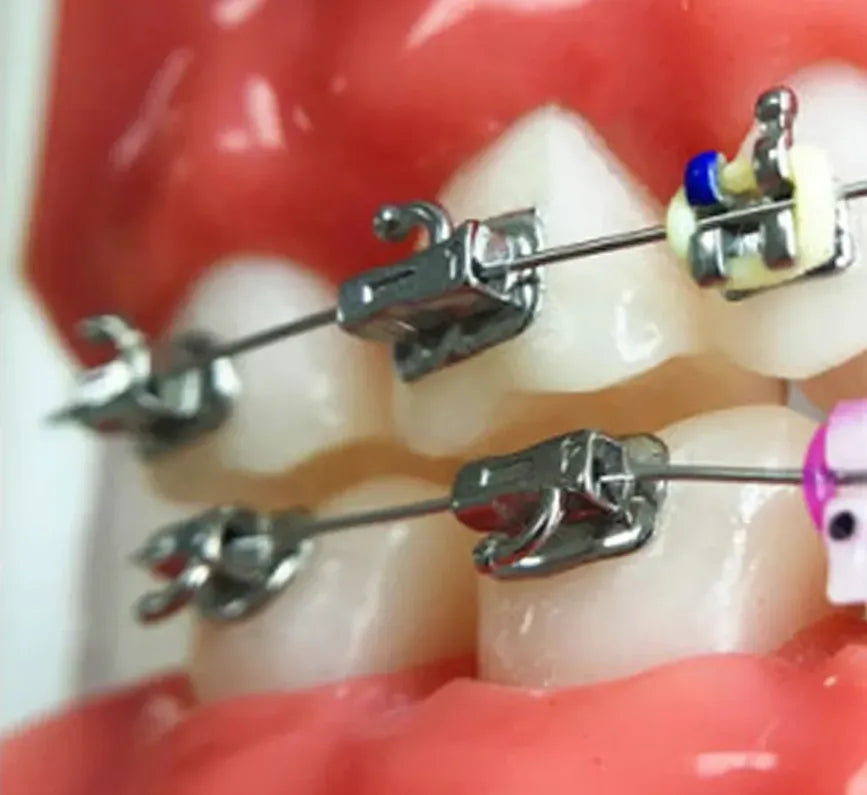 U Ortho Weldable Buccal Tubes -1st Molar MBT 0.022