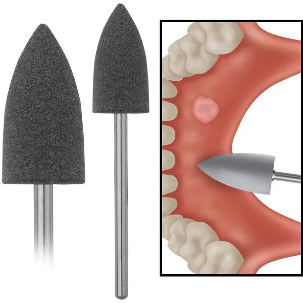 ET Dental Acrylic Polishers Points Big (Pack of 1)
