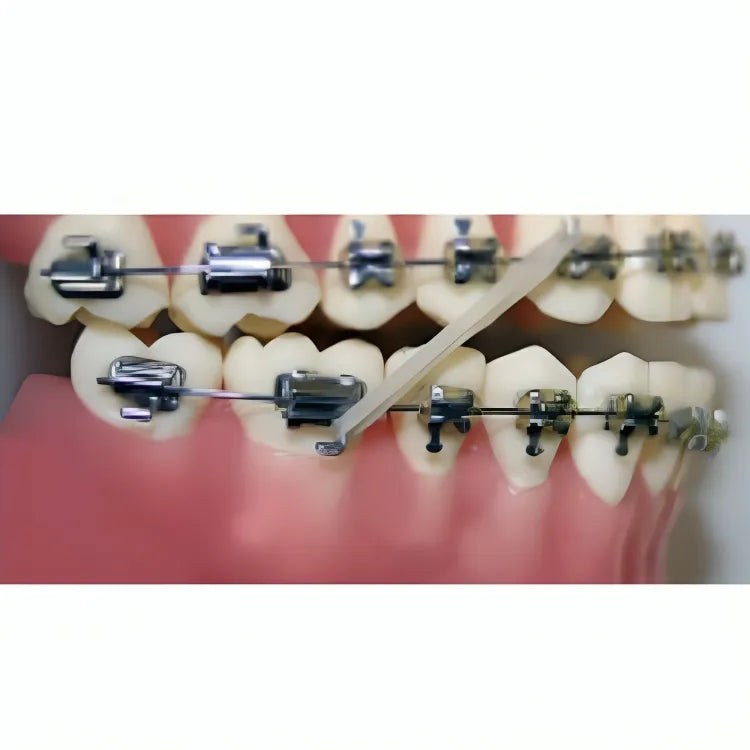 U Ortho Bondable Buccal Tubes - 1st Molar MBT 0.022