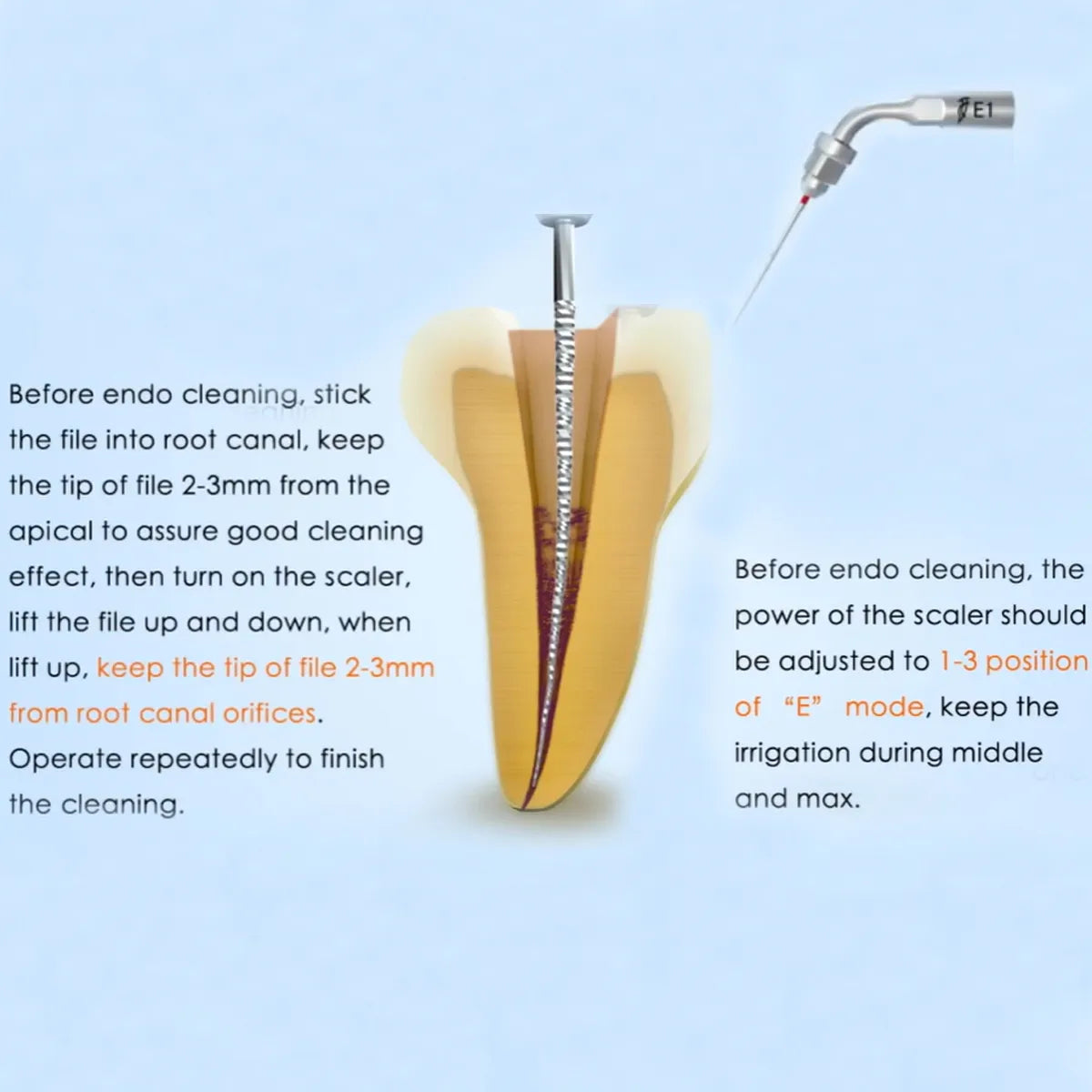 Woodpecker Scaler Tip E1 for UDS & EMS Scalers