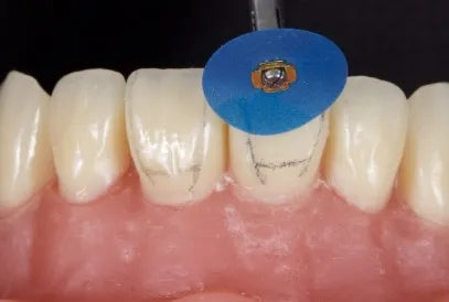 Tor Vm Finishing & Polishing Kit