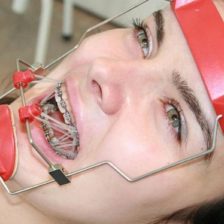 Penta Ortho Extraoral Elastics (Heavy)