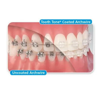 U ortho Niti Tooth Color Wire-Rectangular