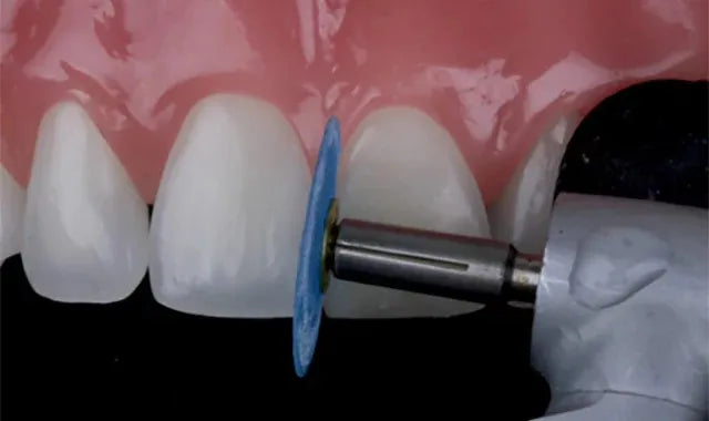 Tor Vm Finishing & Polishing Kit