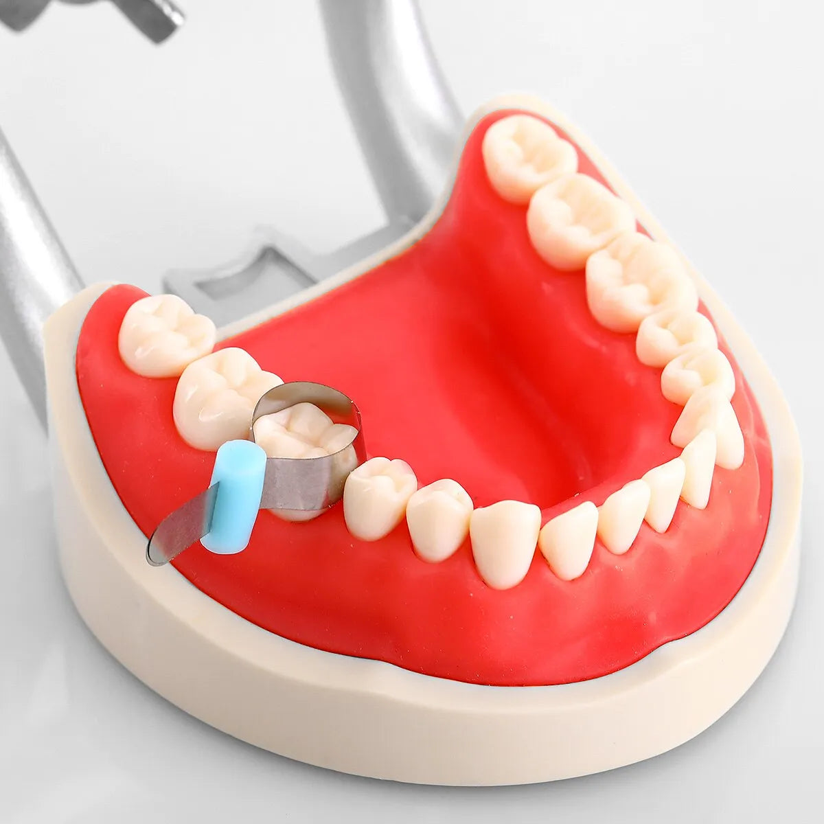 ET Dental Automatrix Metal Bands With Locker