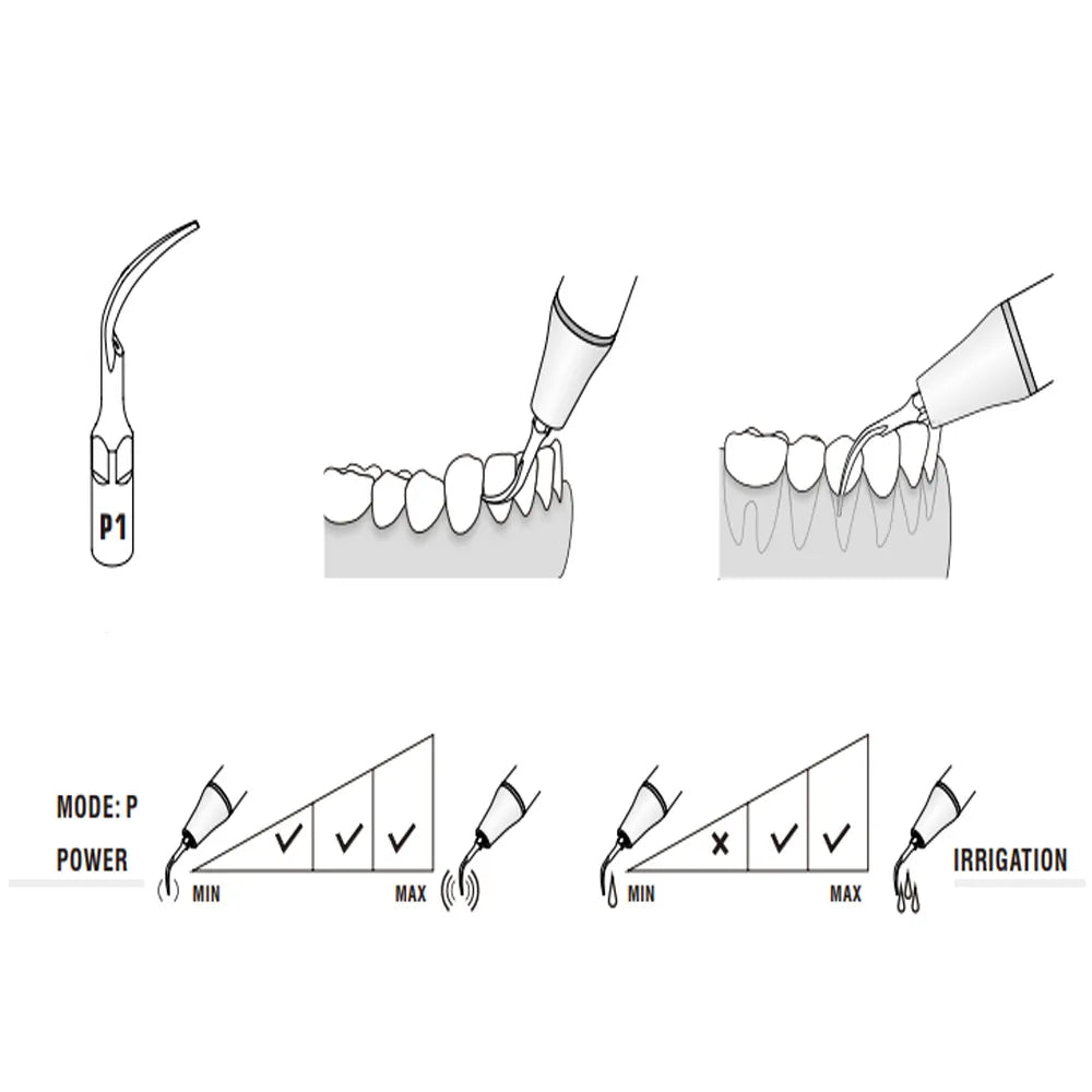 Woodpecker Scaler Tip for UDS & EMS Scalers