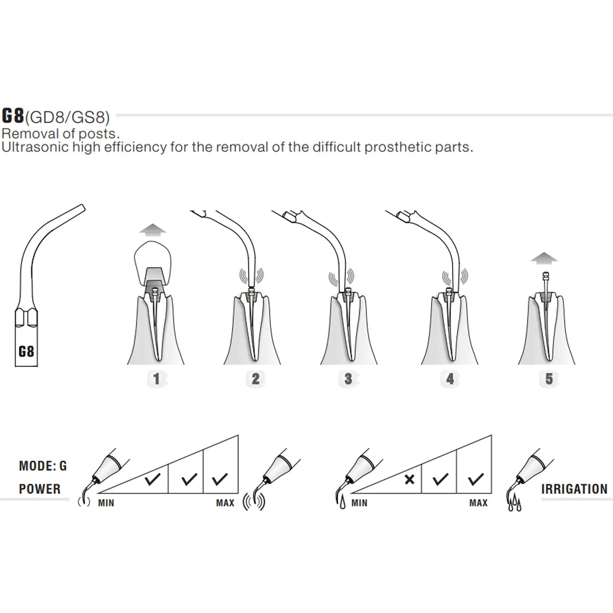 Woodpecker Scaler Tip G8 for UDS & EMS Scalers