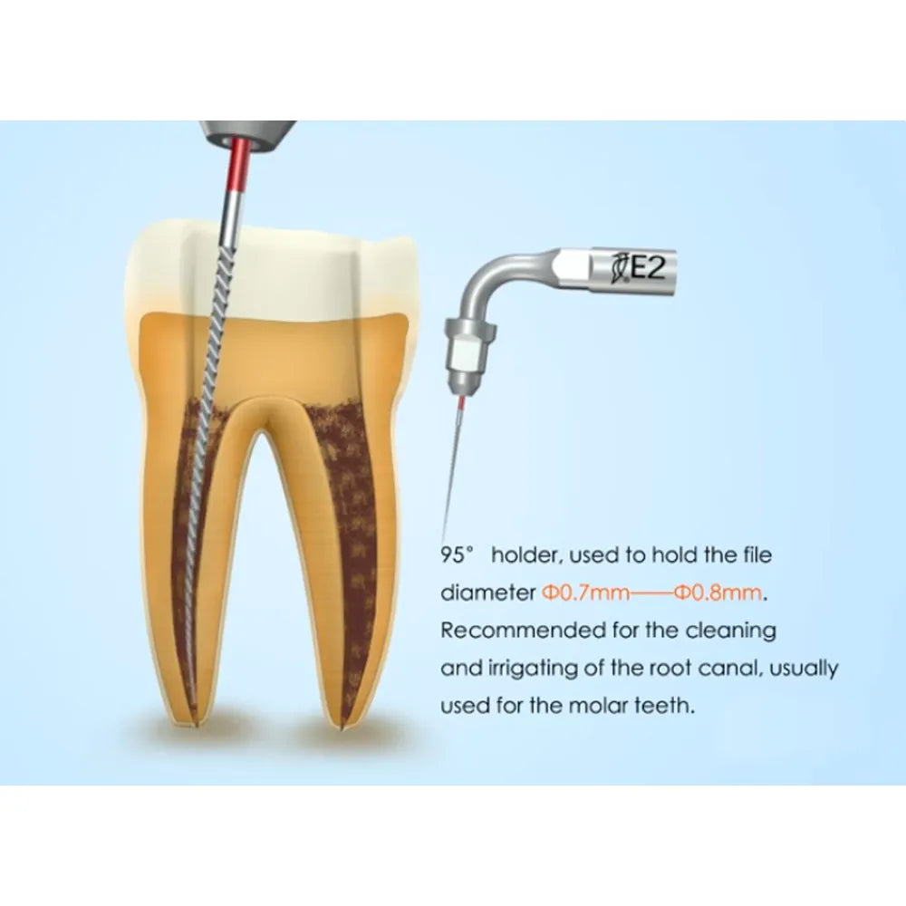 Woodpecker Scaler Tip for UDS & EMS Scalers