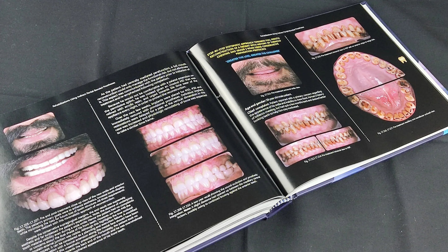 Clinical Fixed Prosthodontics- 2nd Edition Master Volume By Dr. Moez I Khakiani