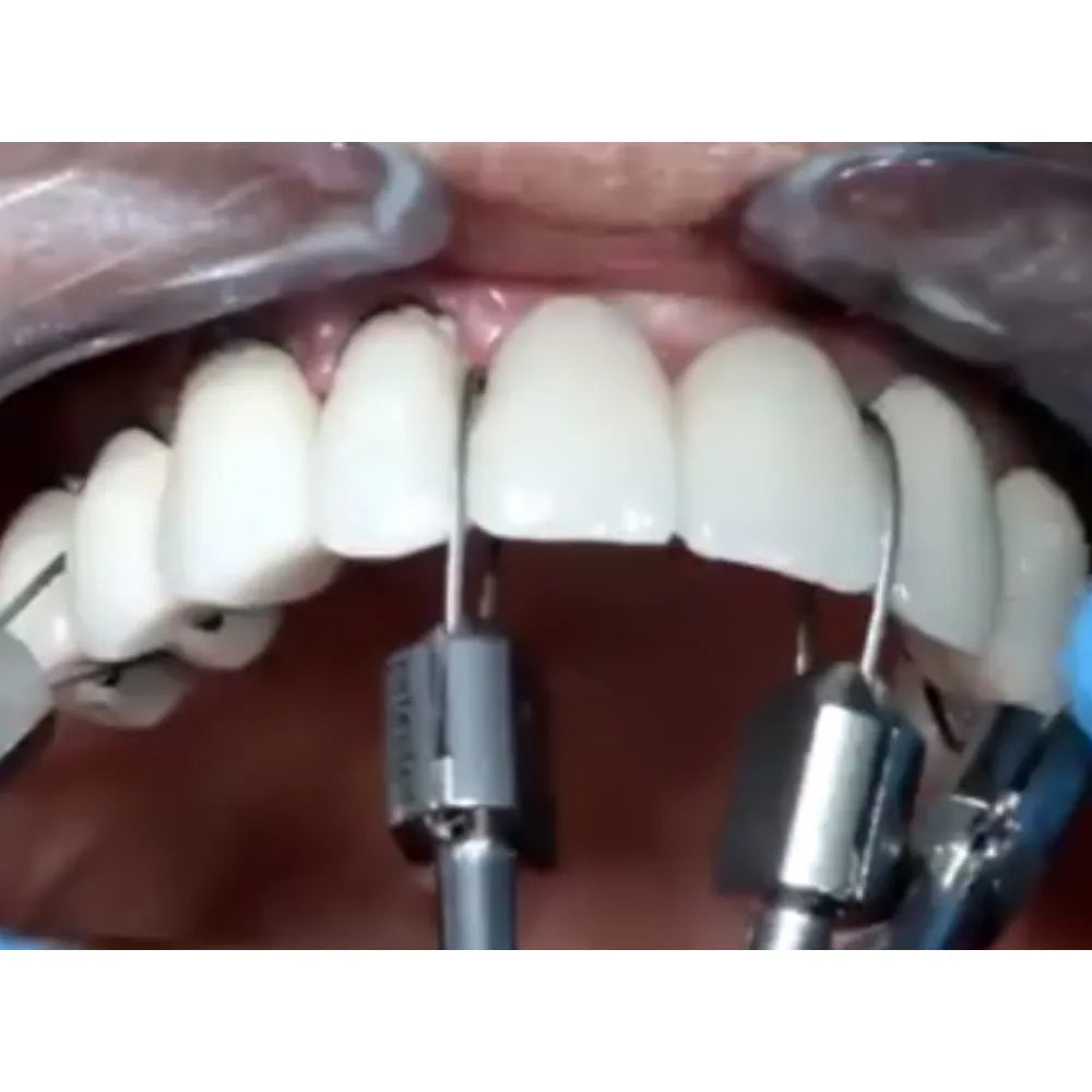 GDC Crown Remover Tip (CR8)