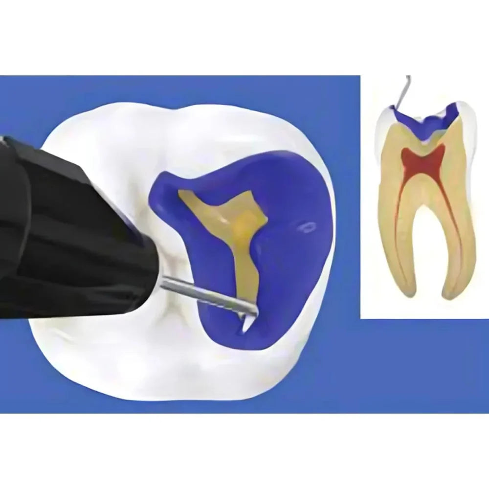 2gm Prime Dental Restorite Cal