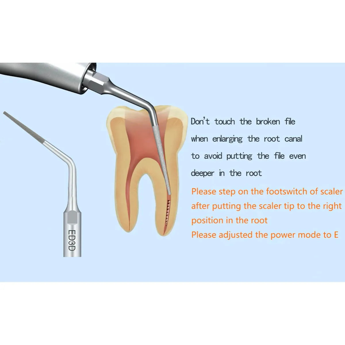 Woodpecker Scaler Tip ED3D for DTE & Satelec Scalers