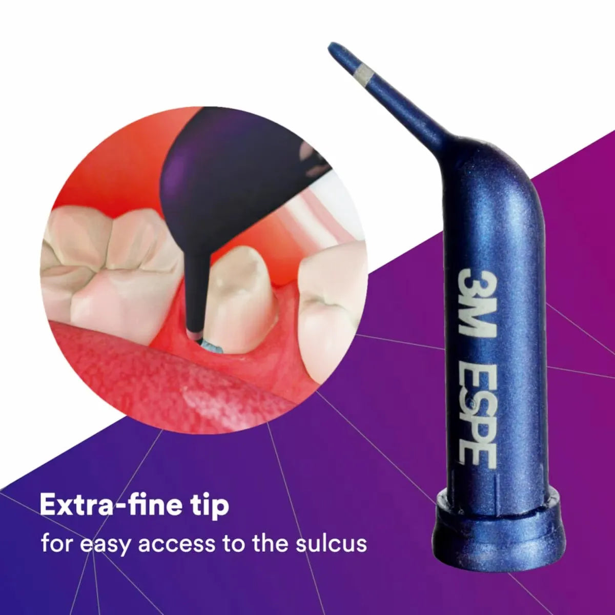 3M Espe Astringent Retraction Material - Paste