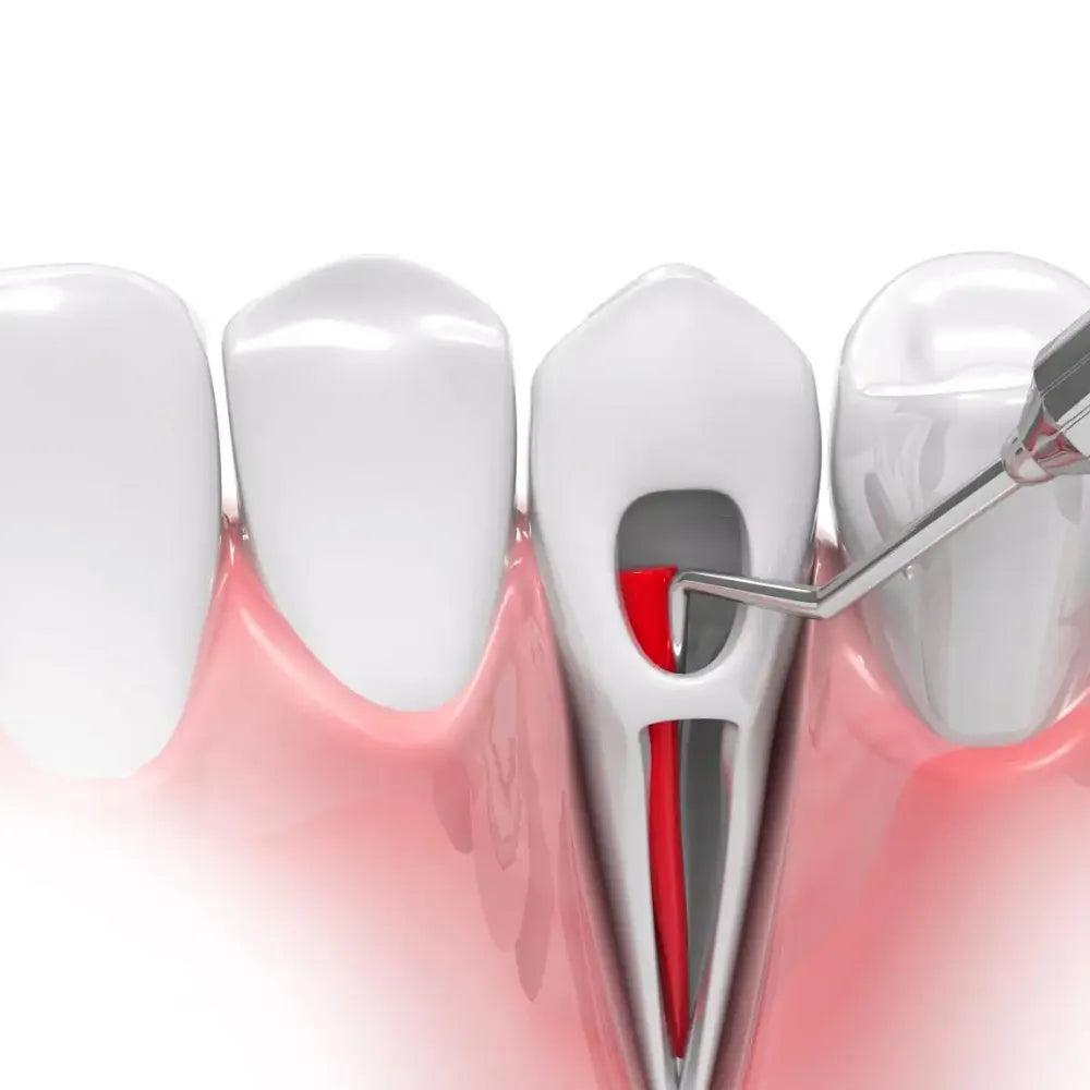 GDC Root Canal Plugger - (.60mm) RCP60 #3
