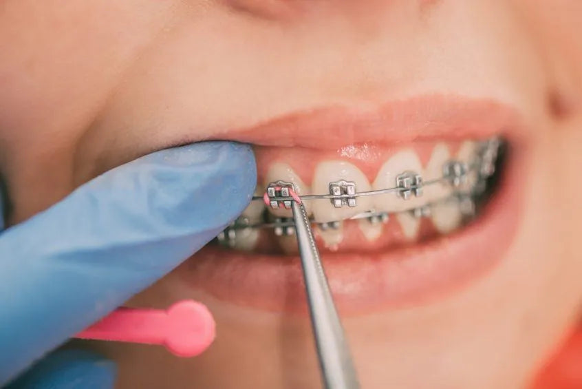 Phyx Elastic Ligature Ties