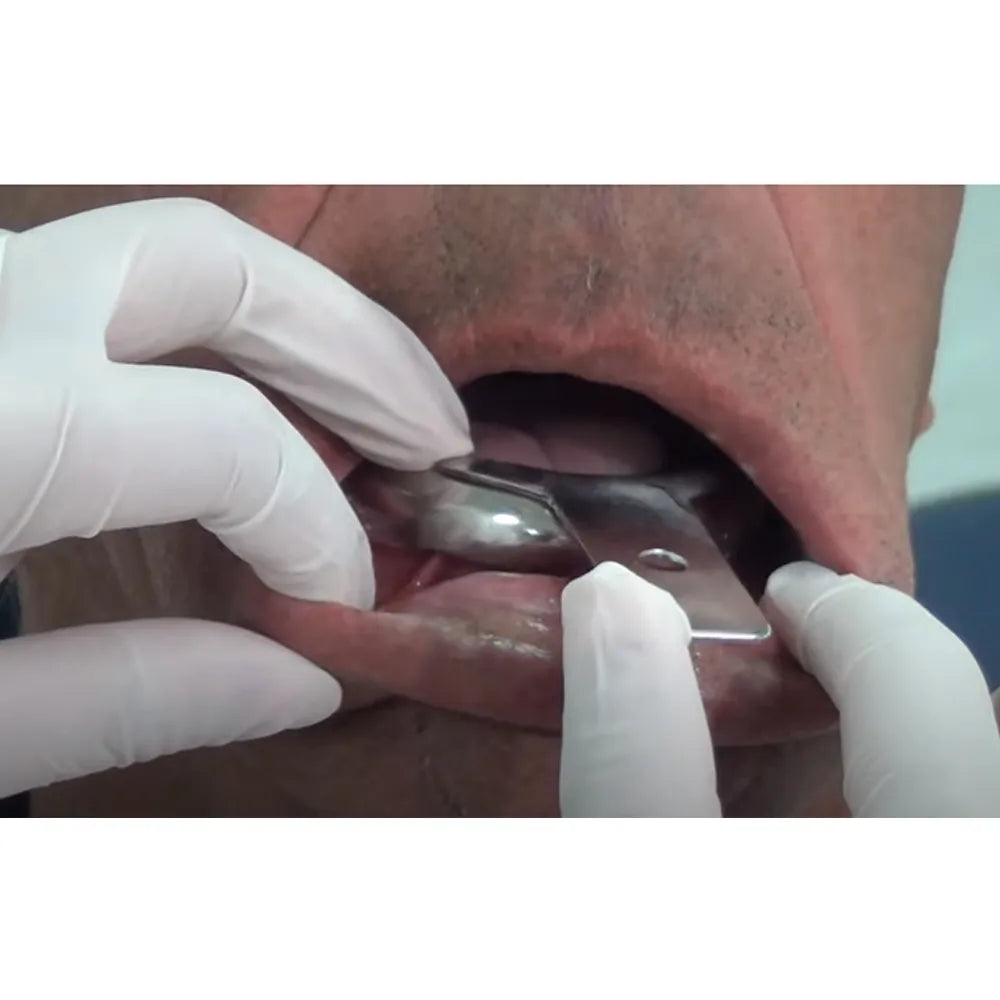 GDC Edentulous Non-Perforated Impression Trays Lower #4 (ITRLEDNPL4)