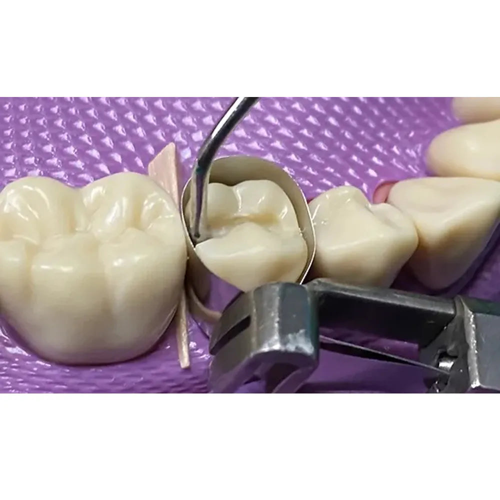 GDC Plastic Filling Instrument - 3 (PFGFT1)