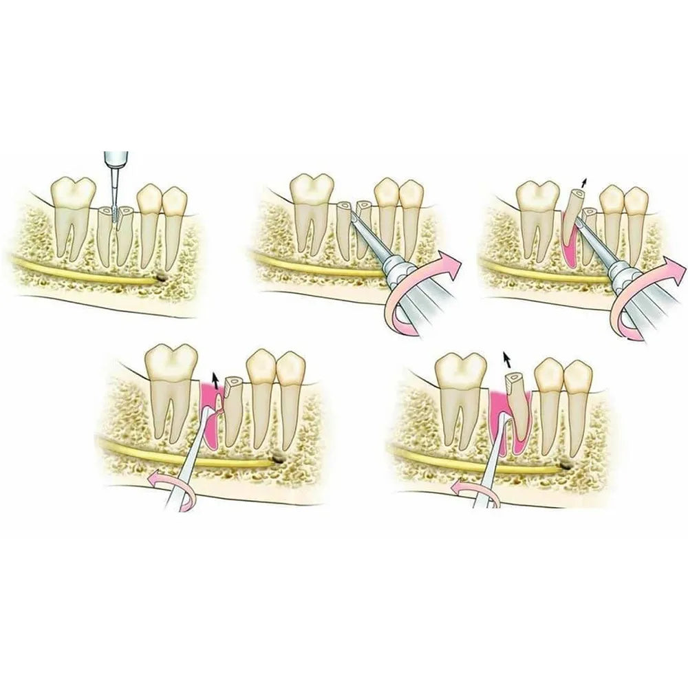 GDC Root Elevator Set Of 9 In Pouch (RESP9)