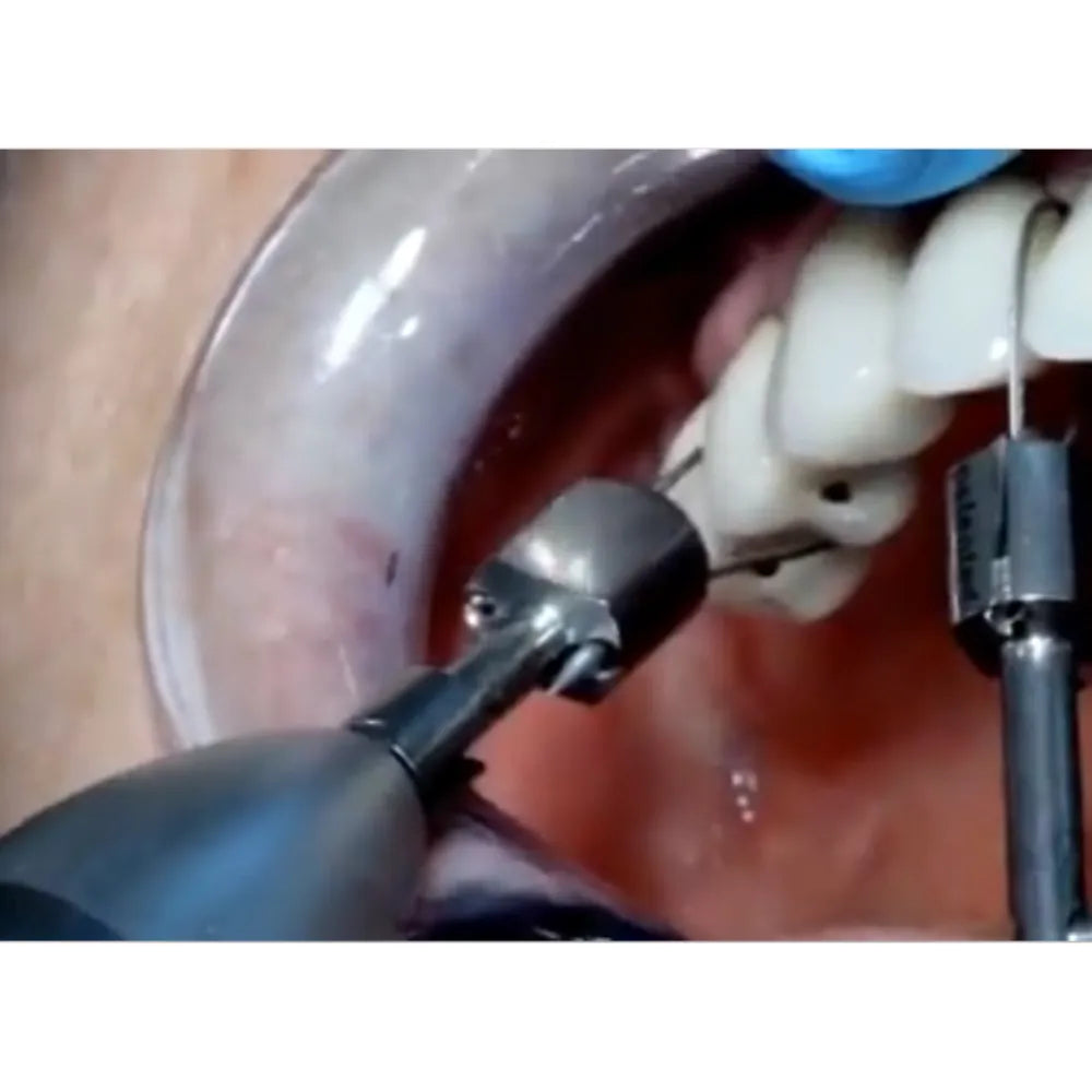 GDC Crown Remover Tip (CR8)