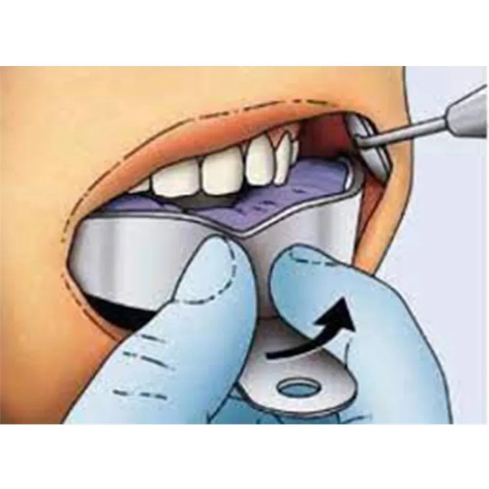 GDC Dentulous Non-Perforated Impression Trays Upper # 4 (ITRLDNPU4)