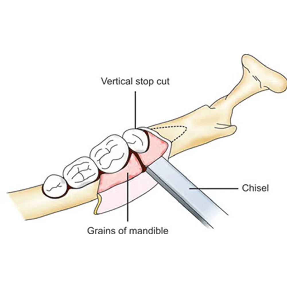 GDC Bone Chisel Chandler (7mm) (CC9)