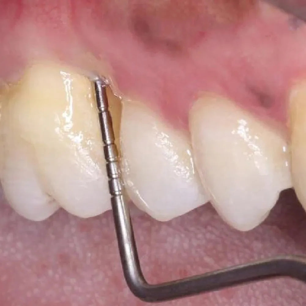 GDC Double End Probes Goldman Fox / William Probe #6 (Pcpgf/W6)