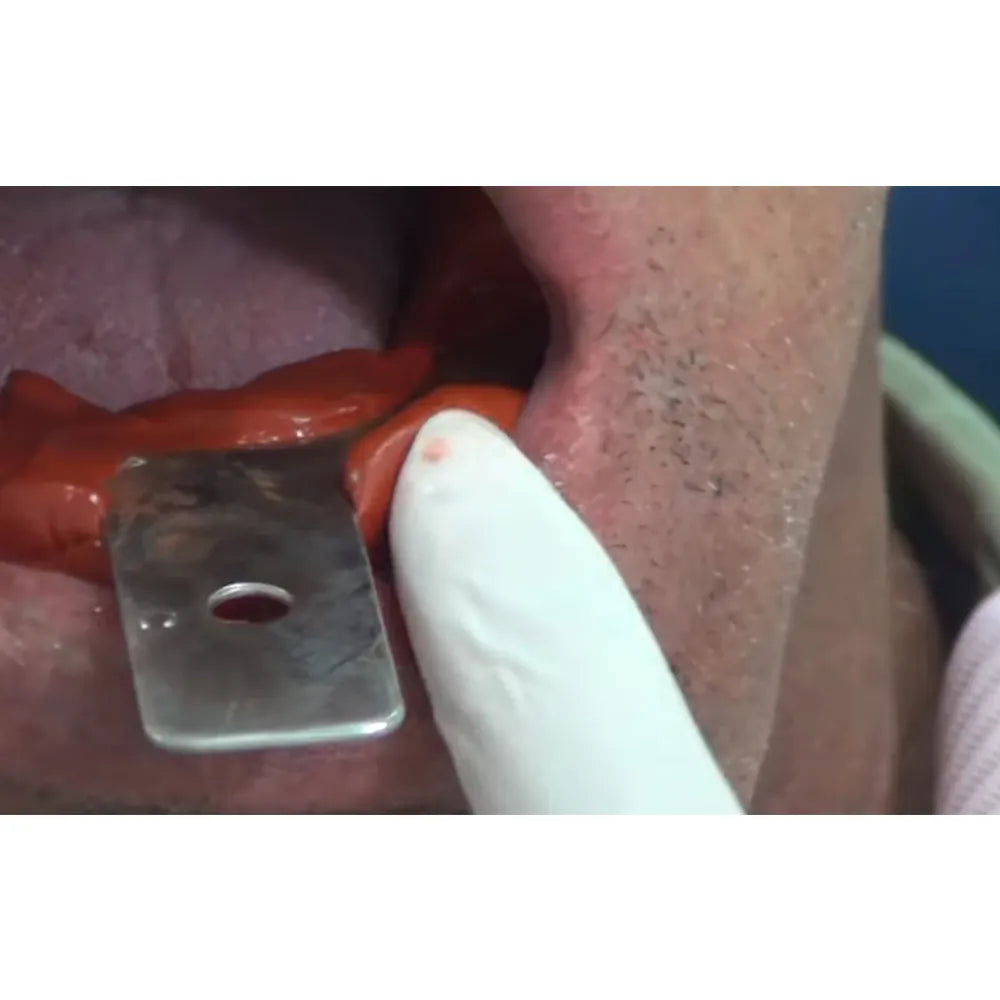 GDC Edentulous Non-Perforated Impression Trays Lower #4 (ITRLEDNPL4)