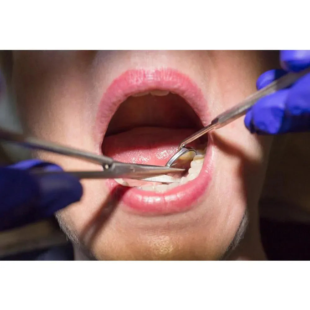 GDC Scissors Noyes - Straight (11cm) (S30)