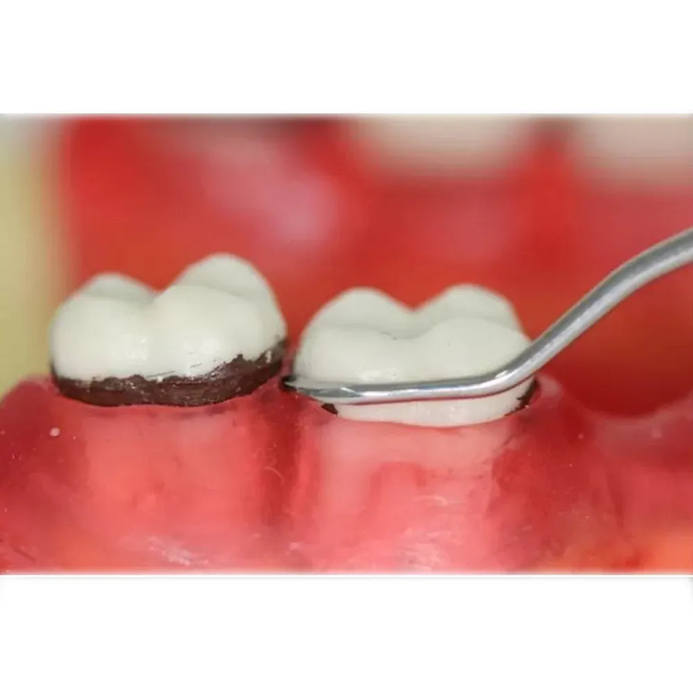 GDC Sickle Scalers Remington #6 (Srm3/4)