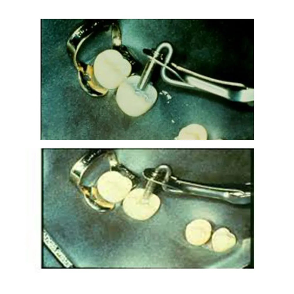 GDC Dental Amalgam Carrier Double Ended - Large/Regular (AC5202)