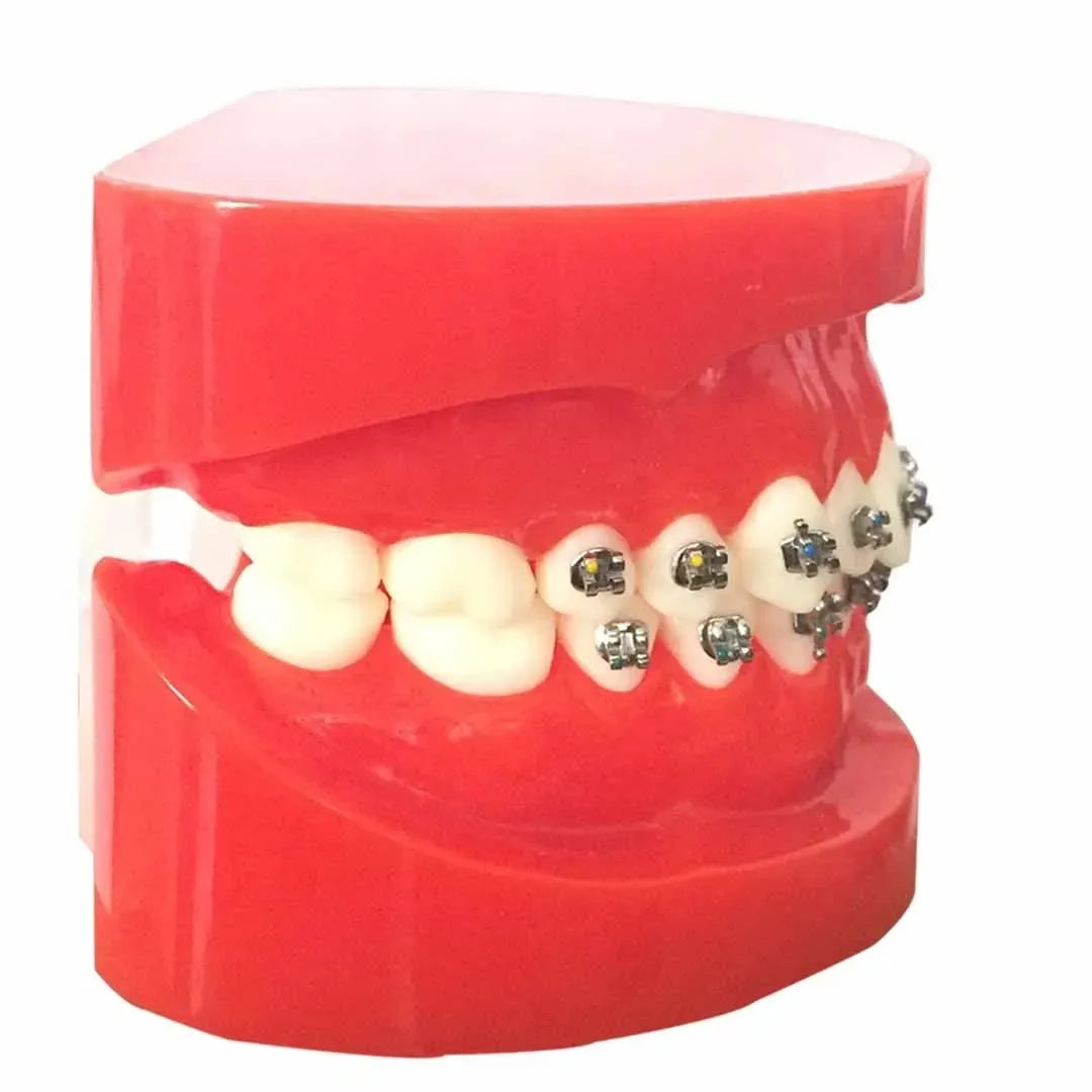 JJ Ortho Class I Orthodontic Model With Metal Brackets (10.10.05)