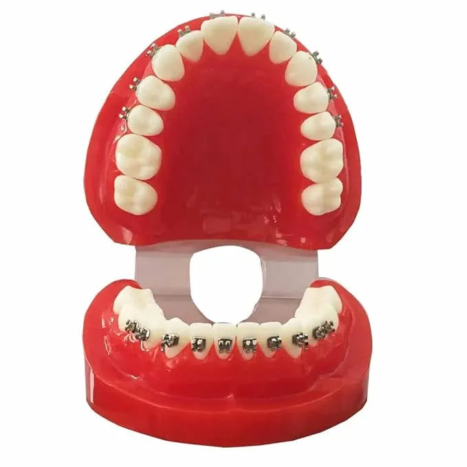 JJ Ortho Class I Orthodontic Model With Metal Brackets (10.10.05)