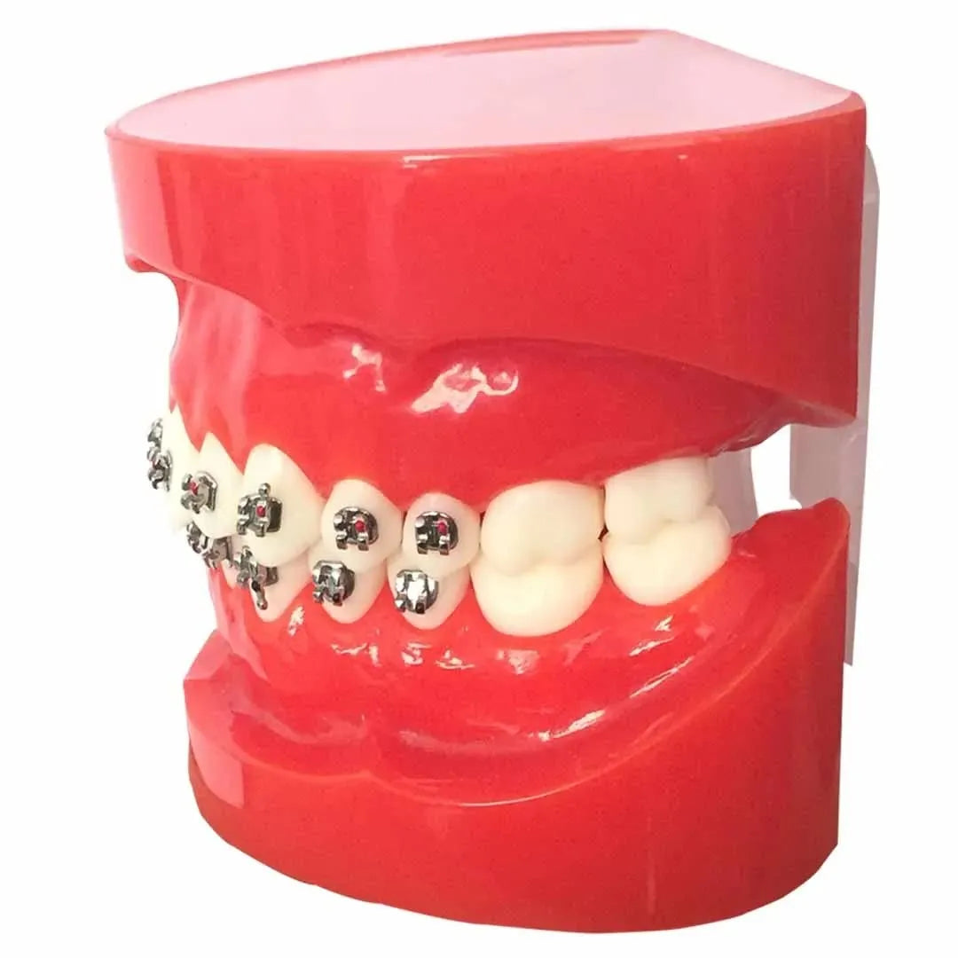 JJ Ortho Class I Orthodontic Model With Metal Brackets (10.10.05)