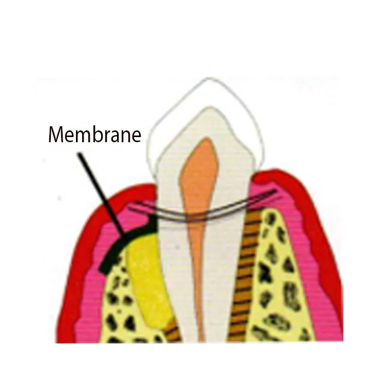 Cologenesis ColoGide GTR Membrane - Pack Of 1