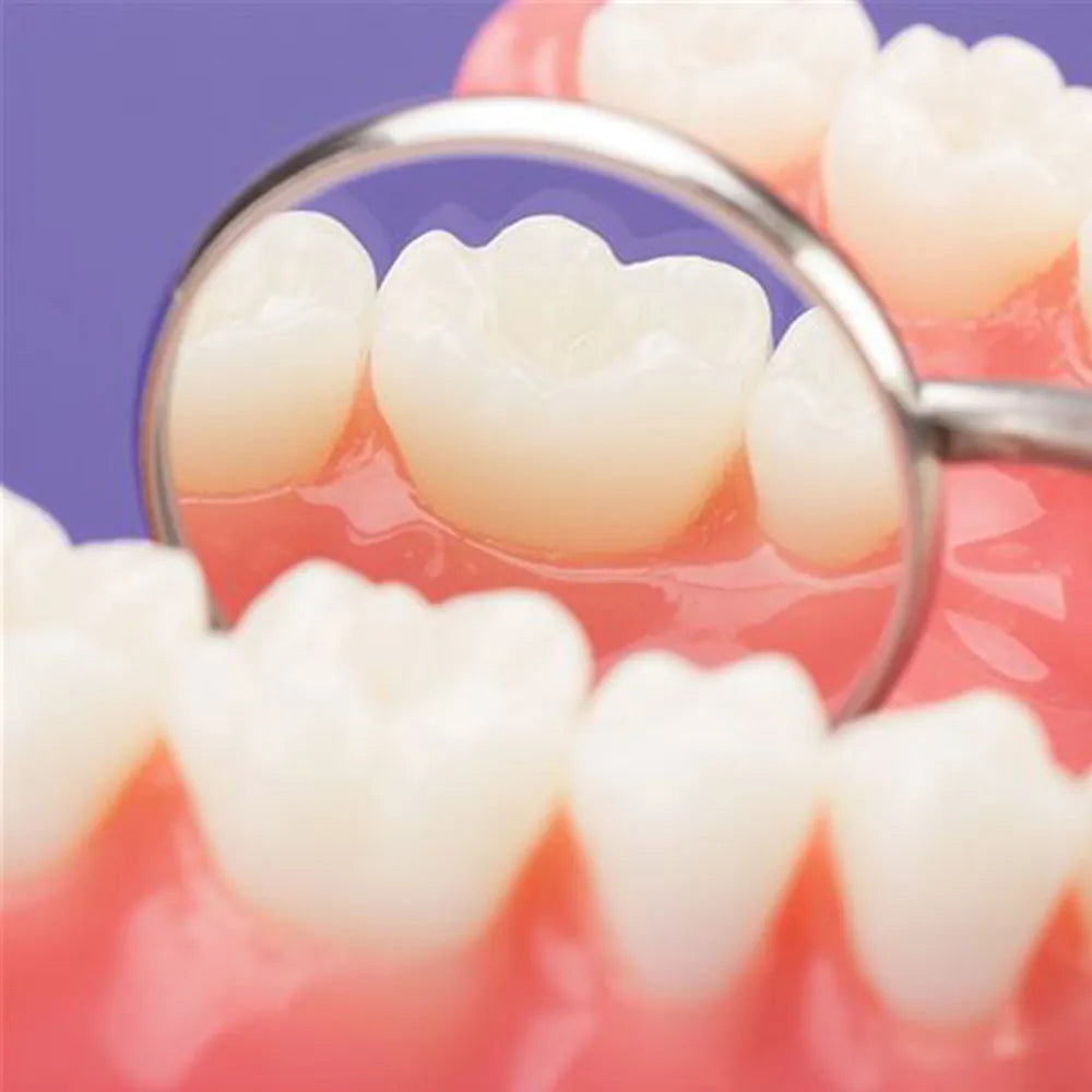 GDC Mouth Mirror Tops Plain Pack Of 12 Pcs - 3 (Mmtp3)
