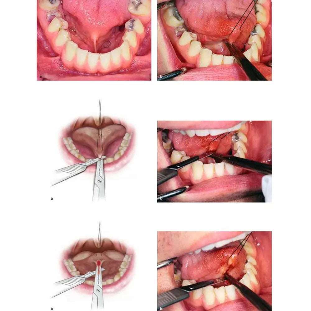 GDC Hemostats Crile Straight - (16cm) (Hrps)