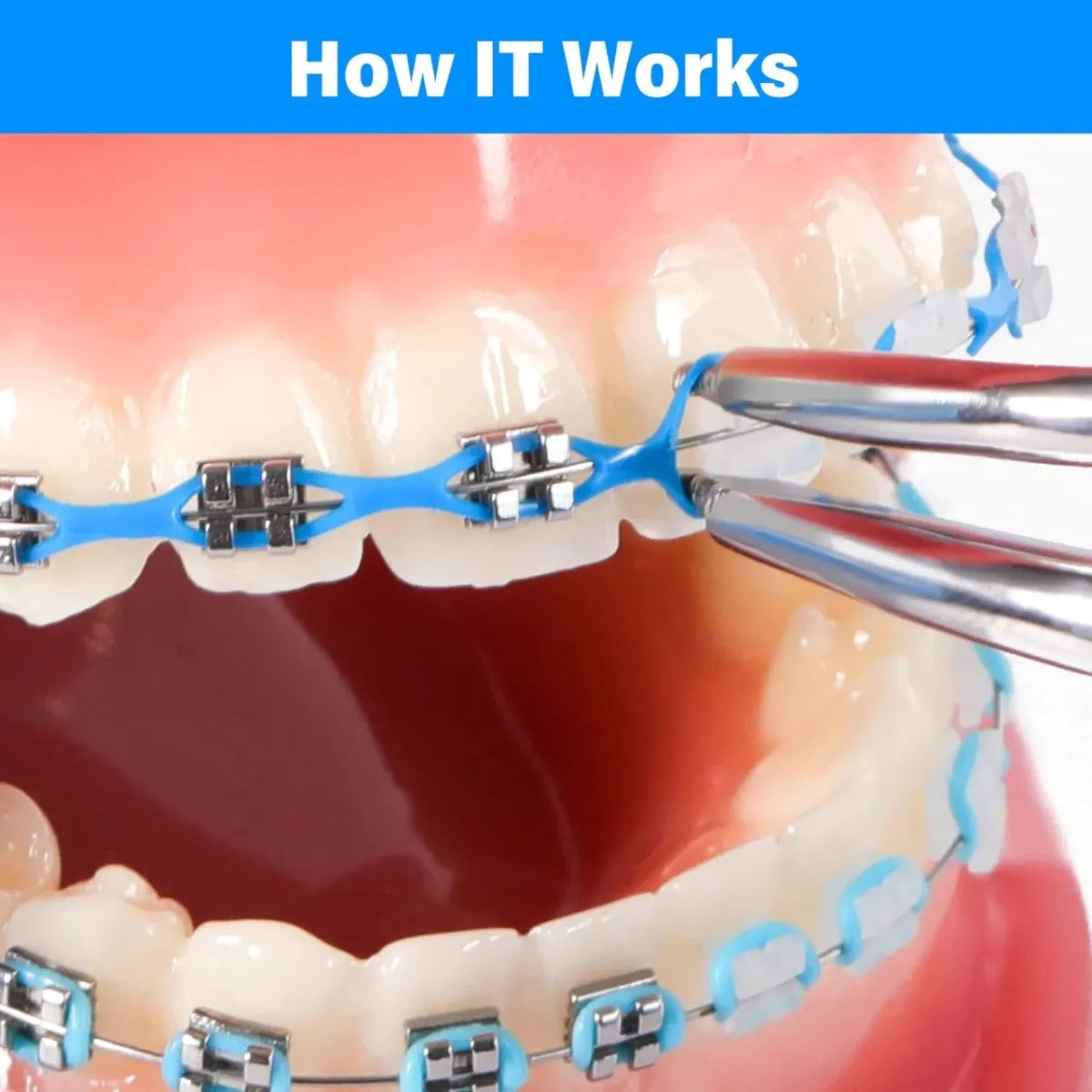 U Ortho E-Chain (15 ft)