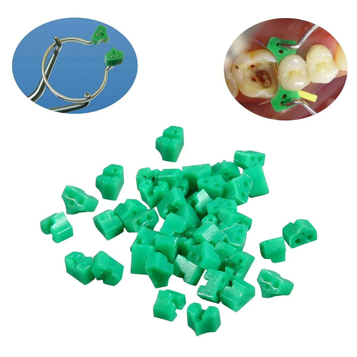Tor Vm Add-On Fixing Wedges (40pcs) No. 1.861