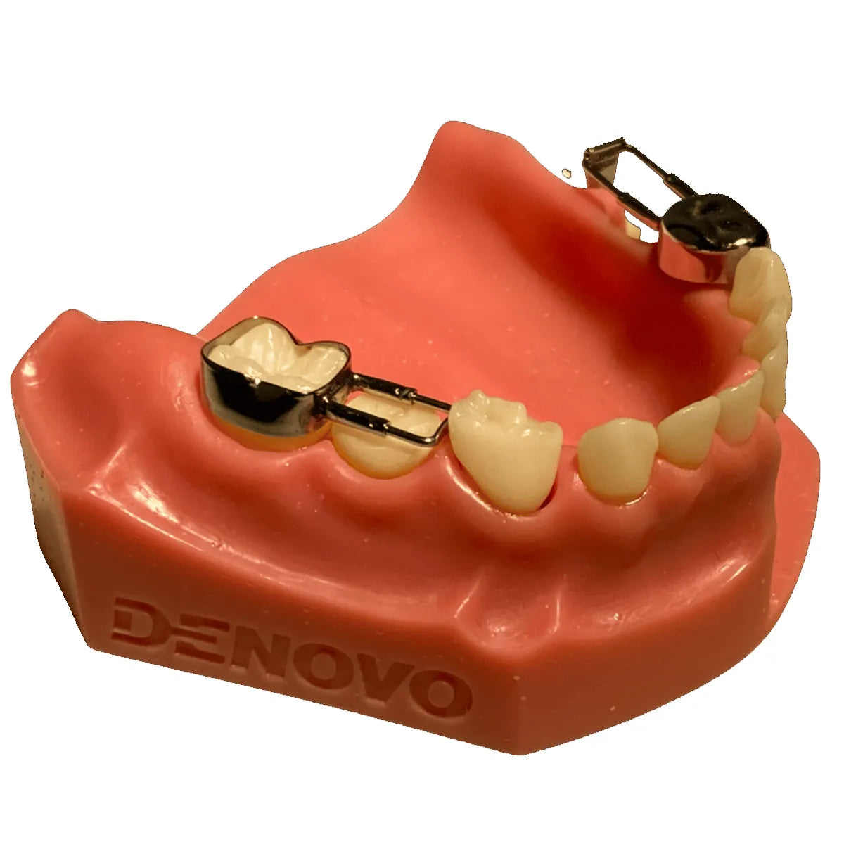 Kids-e-Dental Space Maintainer Band Refills