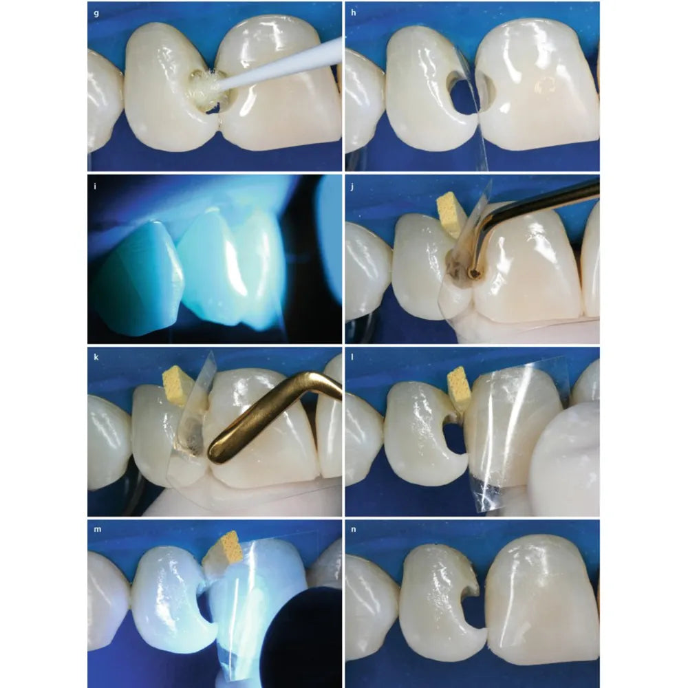 GDC Composite Instrument Gold Titanium Set Of 6 (CIGS6)