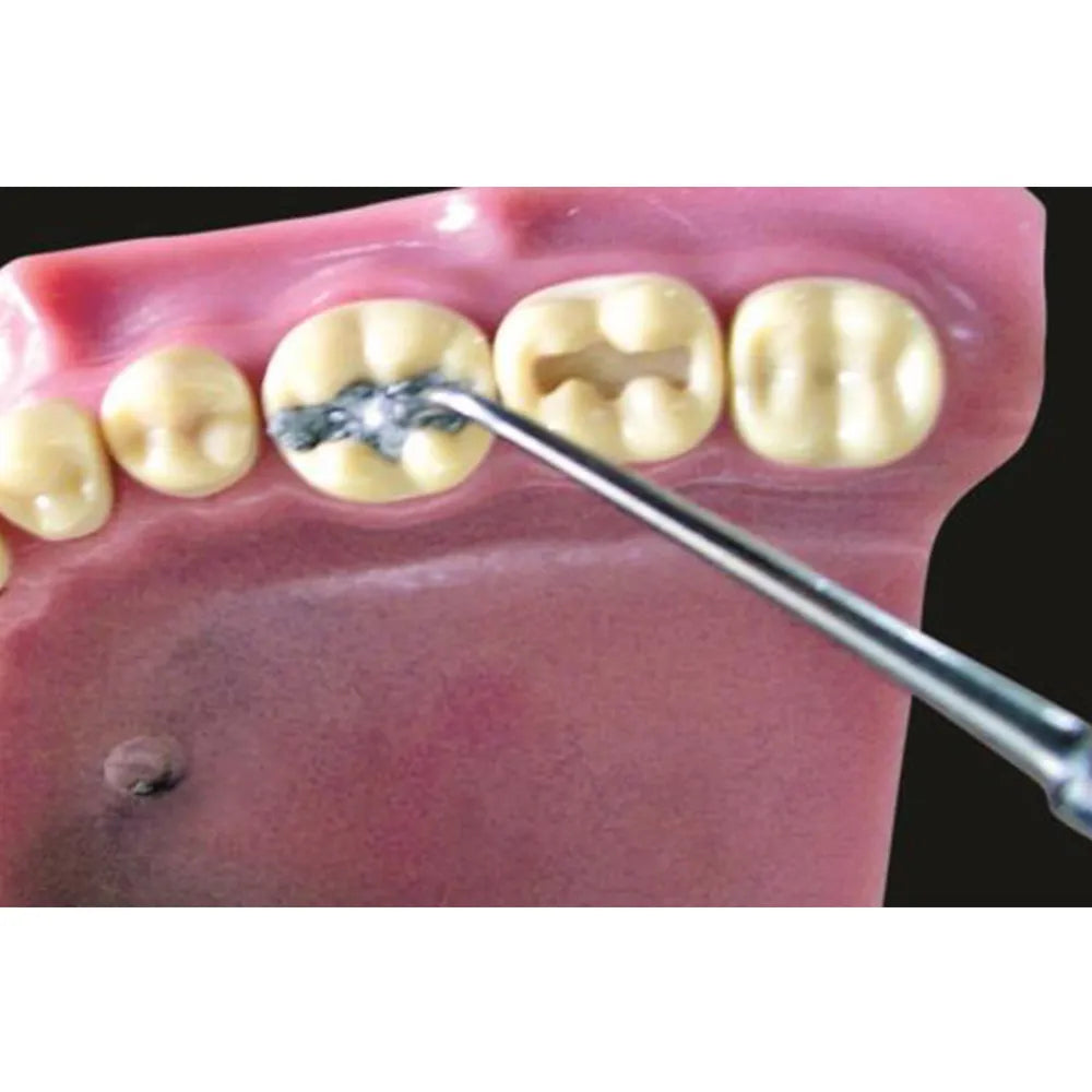 GDC Plastic Filling Instrument - 3 (PFGFT2)