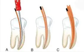 Diadent Pro T Paper Points