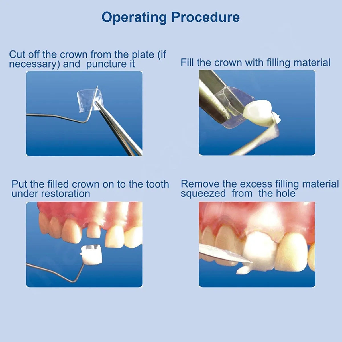 Tor Vm Transparent Crowns 64 pcs- Posterior No 1.911