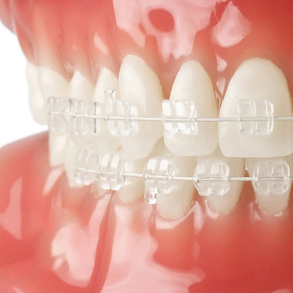 U Ortho SS Tooth Color Wire - Rectangular