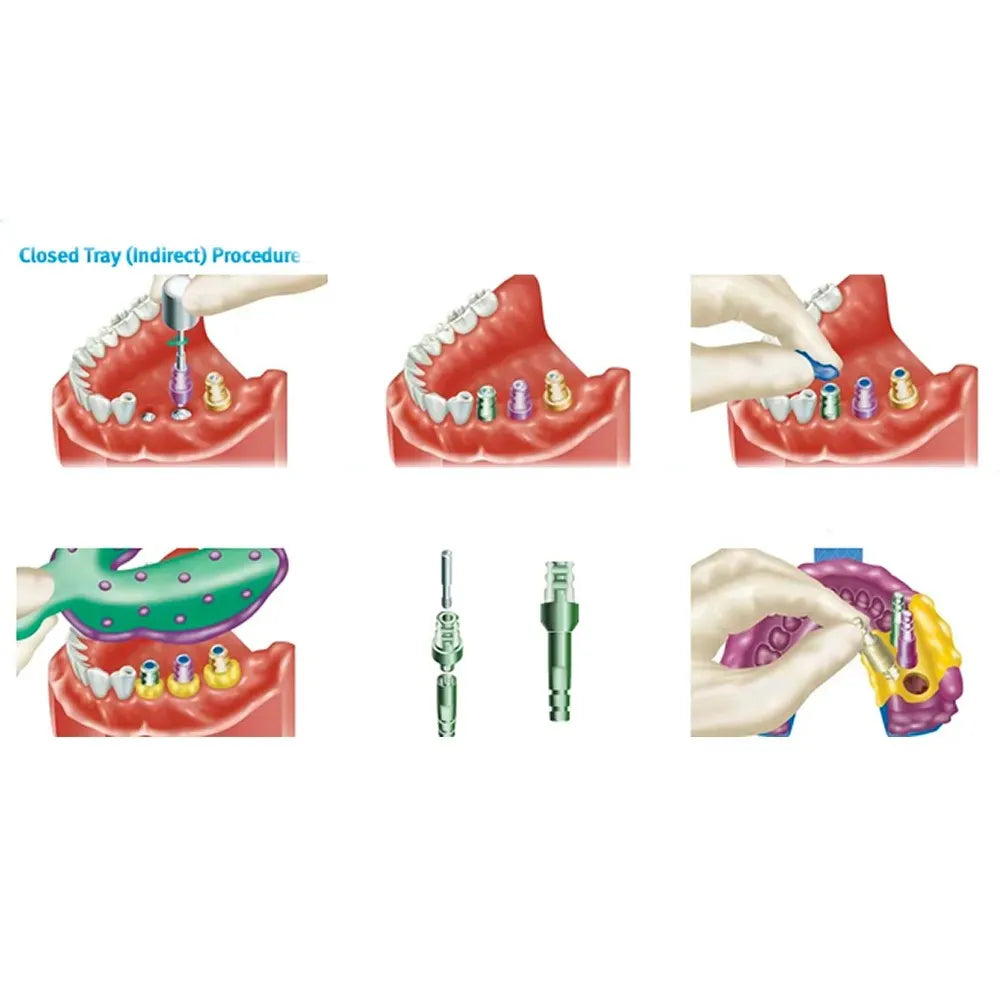 Adin RS Closed Tray Transfer