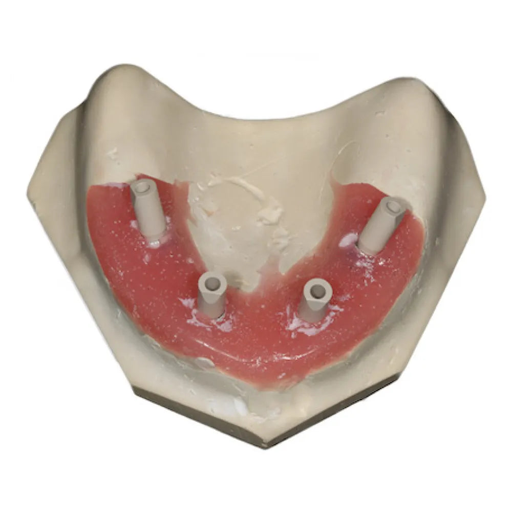 Adin RS Flat Connection Castable Abutment for Centering Ring (FC6011)