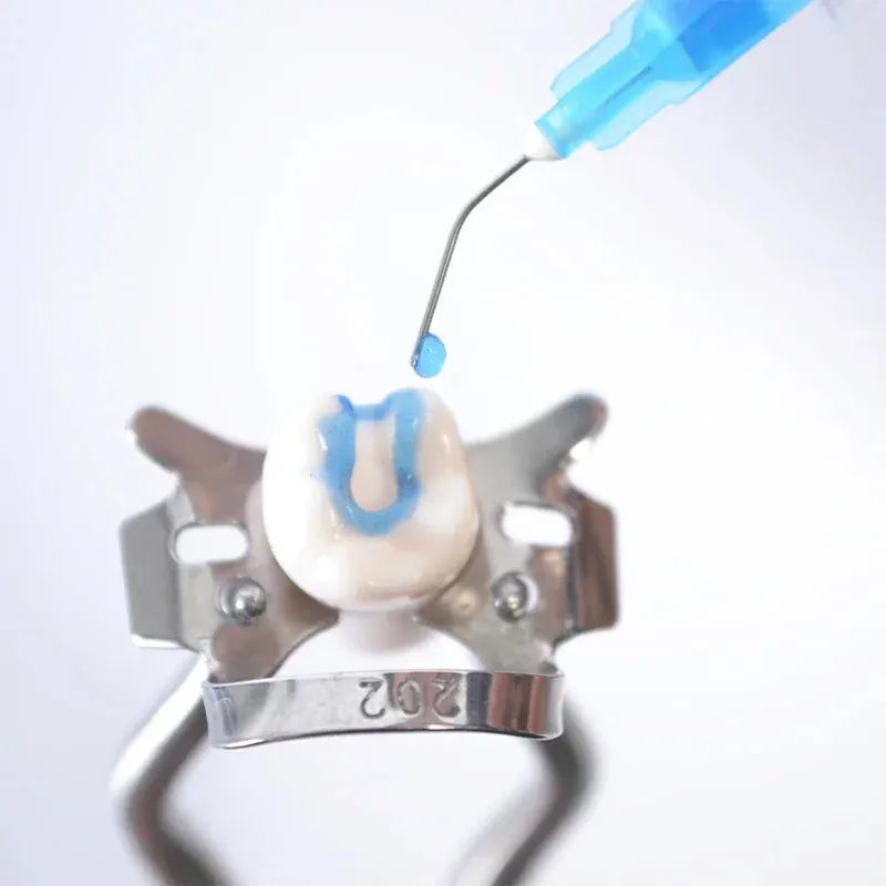 Anabond Eazetch Etchant Gel