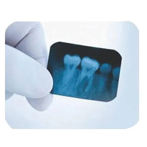 Avue Xpress SD Self Developing X-Ray Films